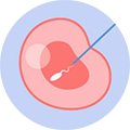 Intraplasmic sperm microinjection